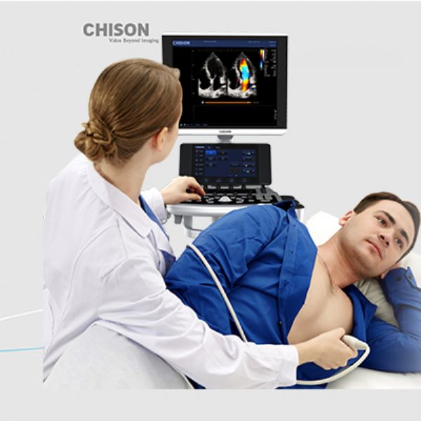 CHISON CBIT8