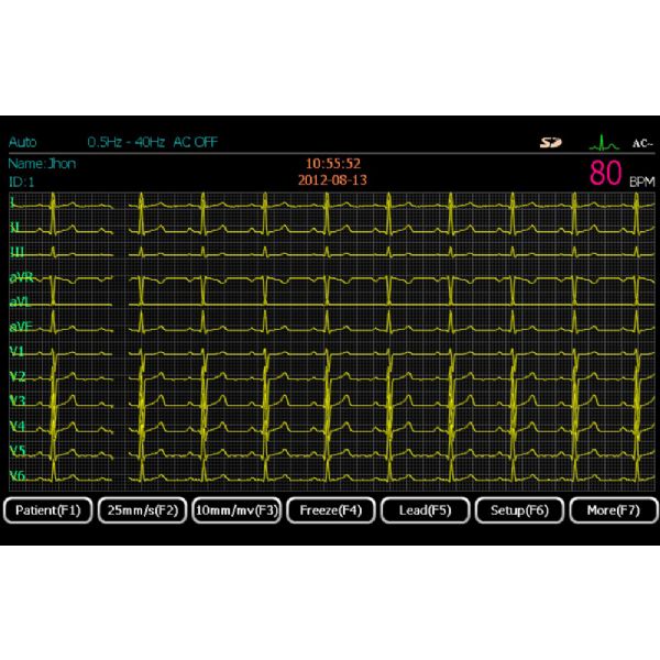 ECGMAC EM1202