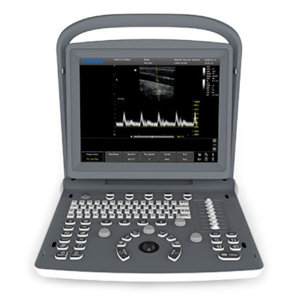 CHISON ECO2