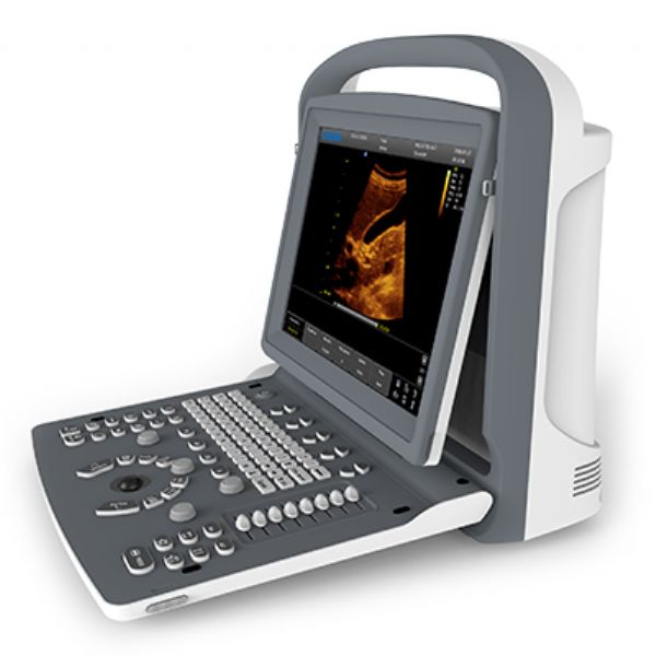 CHISON ECO2