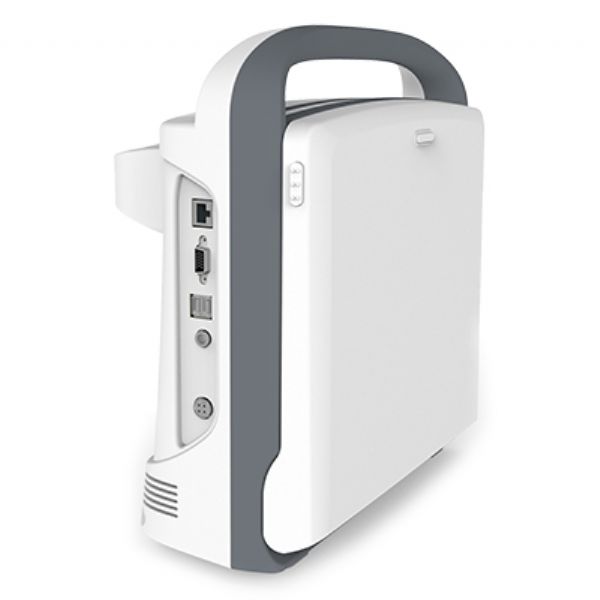 CHISON ECO2