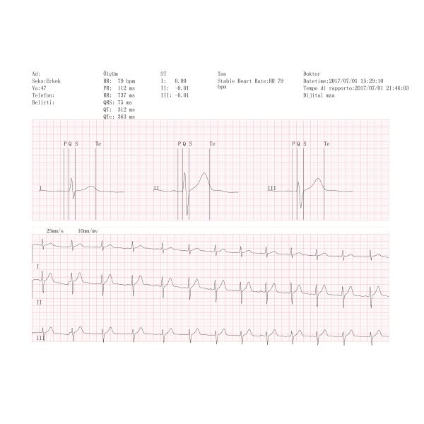 BORSAM WECARDIO PLUS