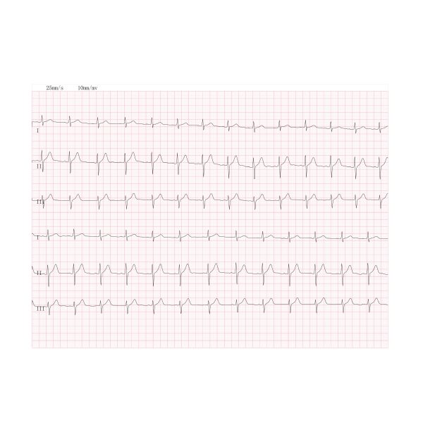 BORSAM WECARDIO PLUS